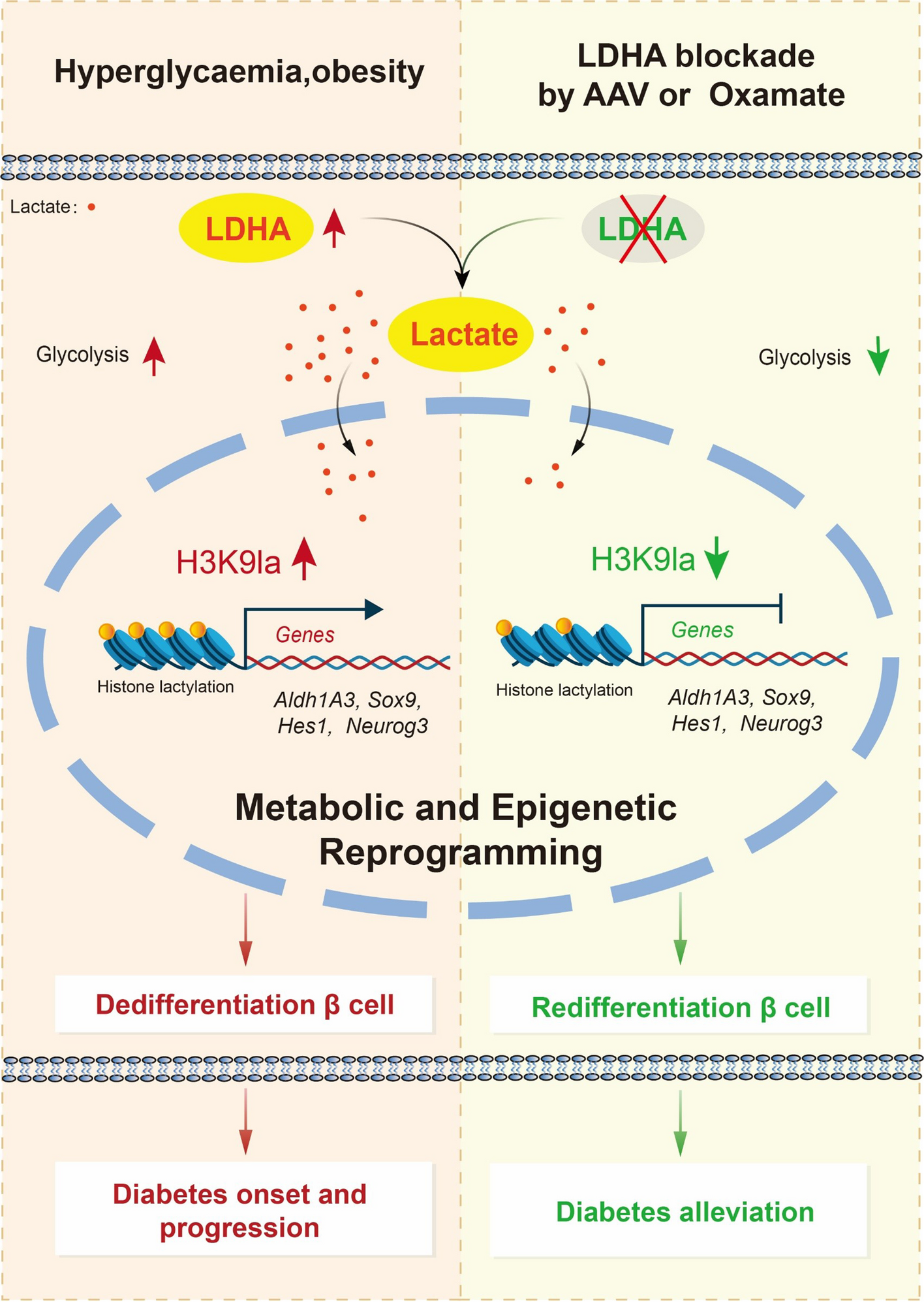 LDHA induces beta cell dedifferentiation in diabetes through metabolic and epigenetic reprogramming