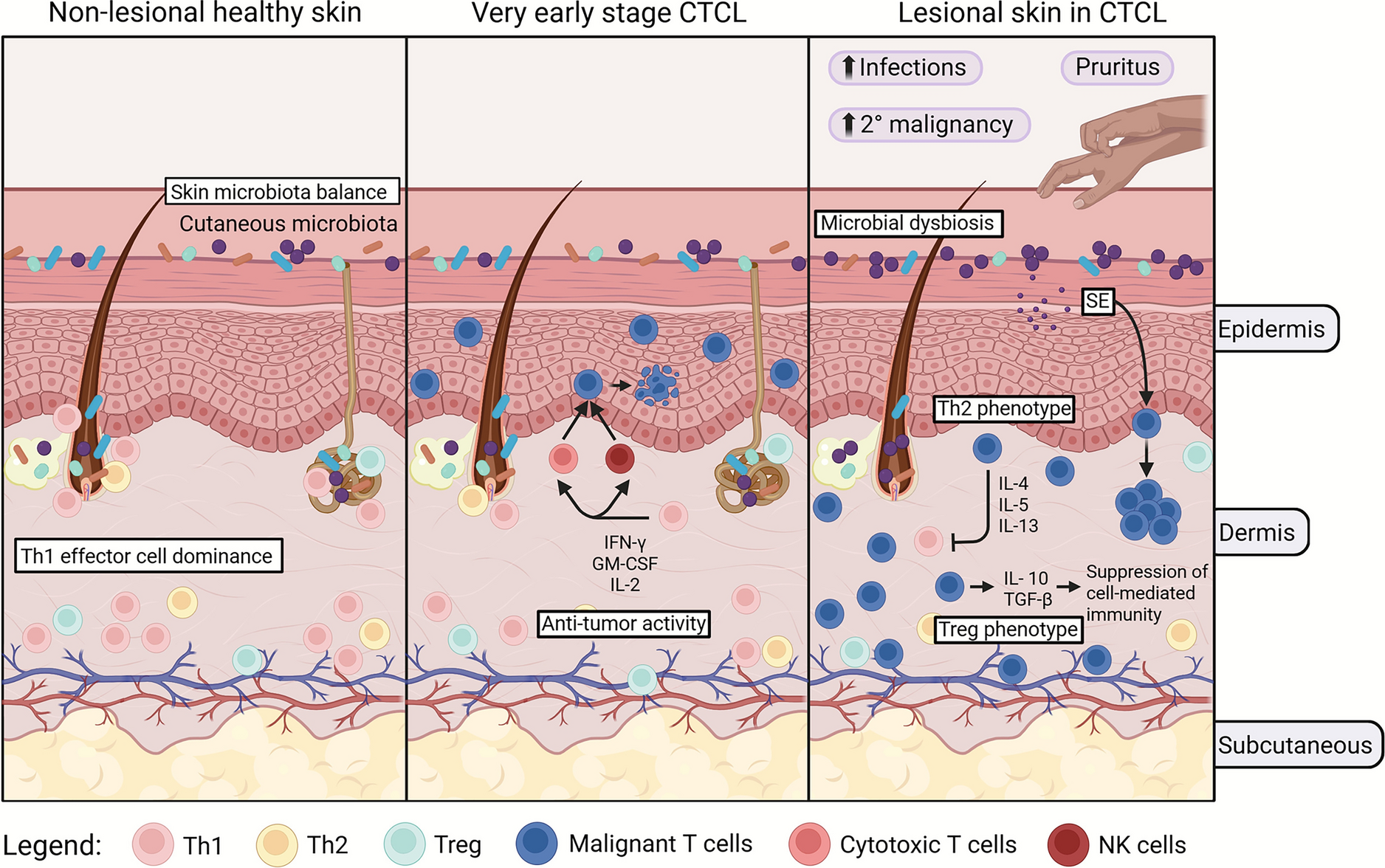 Clinical Implications of the Skin Microbiota in the Therapy of Cutaneous T Cell Lymphoma: A Scoping Review