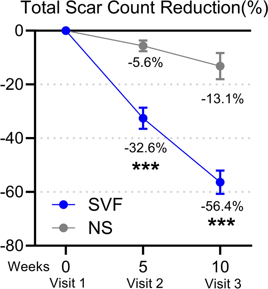 Comparison of Efficacy of Intradermal Stromal Vascular Fraction Injection Versus Saline Injection in the Treatment of Atrophic Acne Scar: A 10-Week, Prospective, Randomized, Split-Face, Single-Blind Controlled Trial