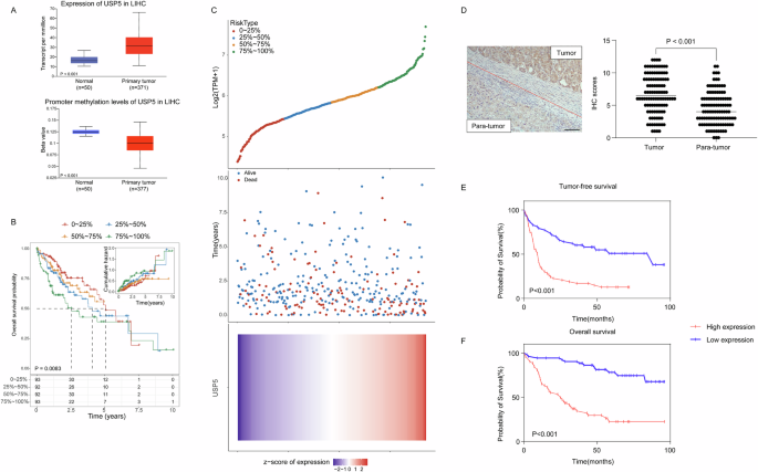 Stabilization of FASN by USP5-mediated deubiquitination promotes hepatocellular carcinoma progression