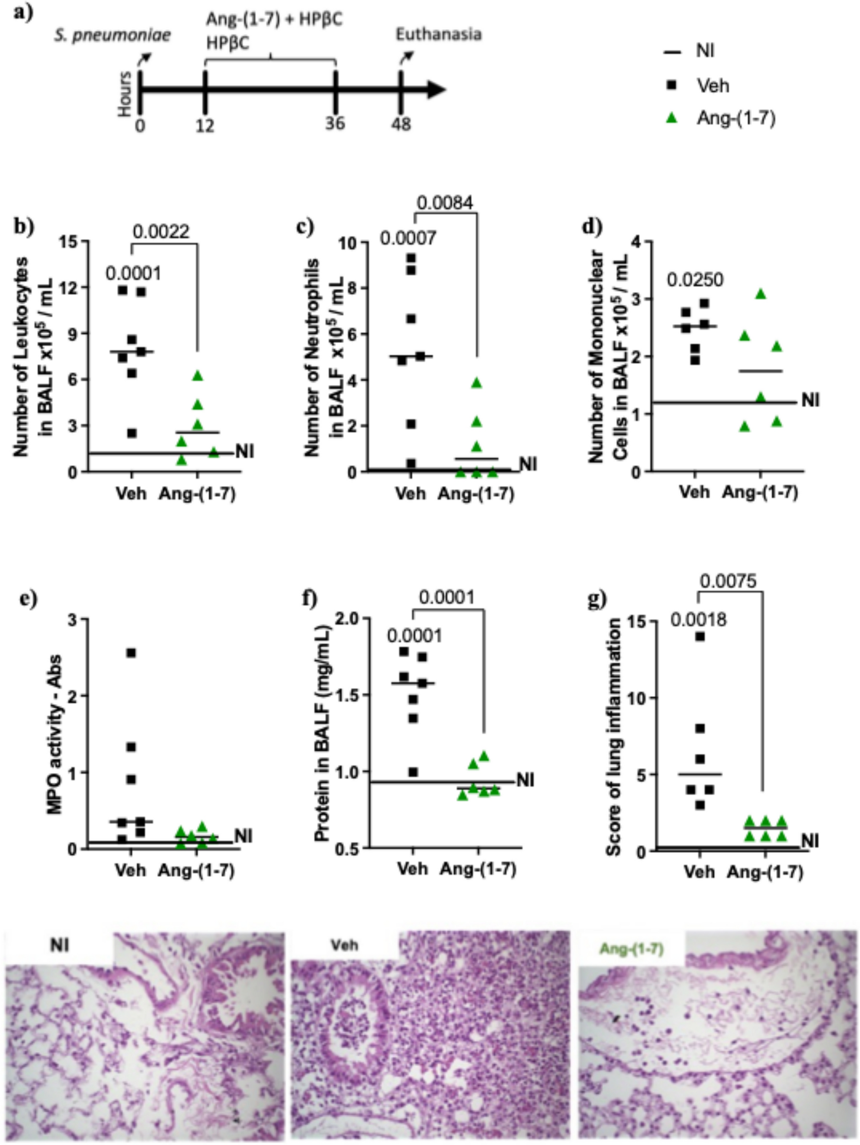 Angiotensin-(1-7) treatment improves pneumonia and prevents sepsis caused by pneumococcal infection