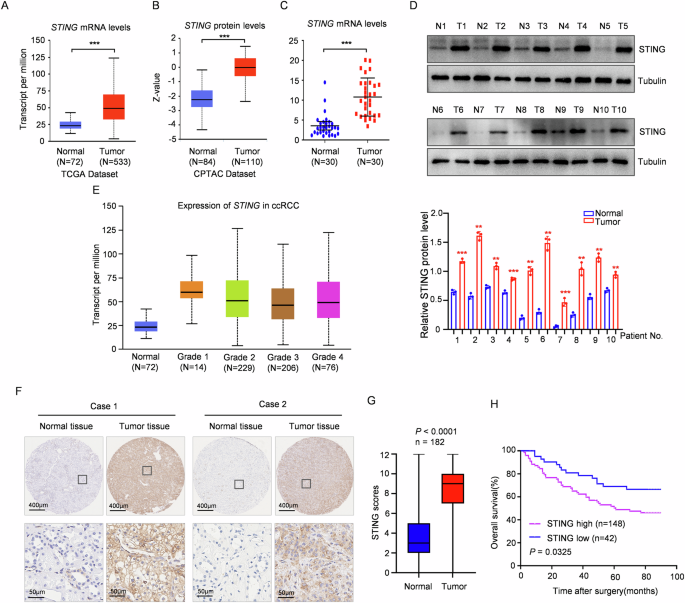 Targeting STING elicits GSDMD-dependent pyroptosis and boosts anti-tumor immunity in renal cell carcinoma