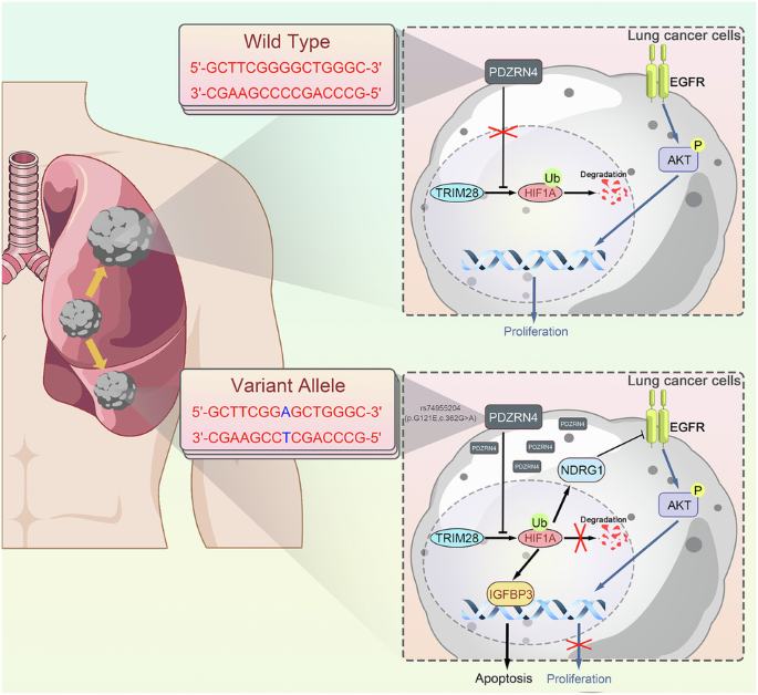 PDZRN4 suppresses lung adenocarcinoma progression via inhibiting ubiquitin-mediated HIF-1A degradation