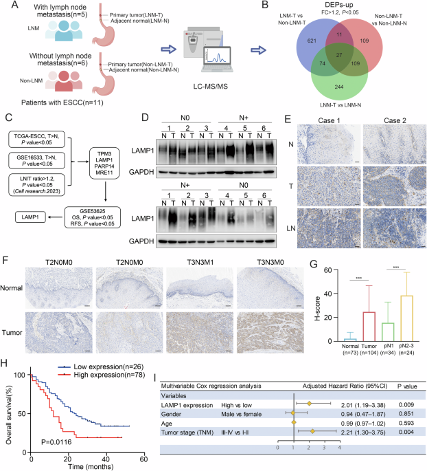 LAMP1 enhances DNA-PKcs-mediated AKT phosphorylation and VEGFC secretion to promote lymph node metastasis in esophageal squamous cell carcinoma