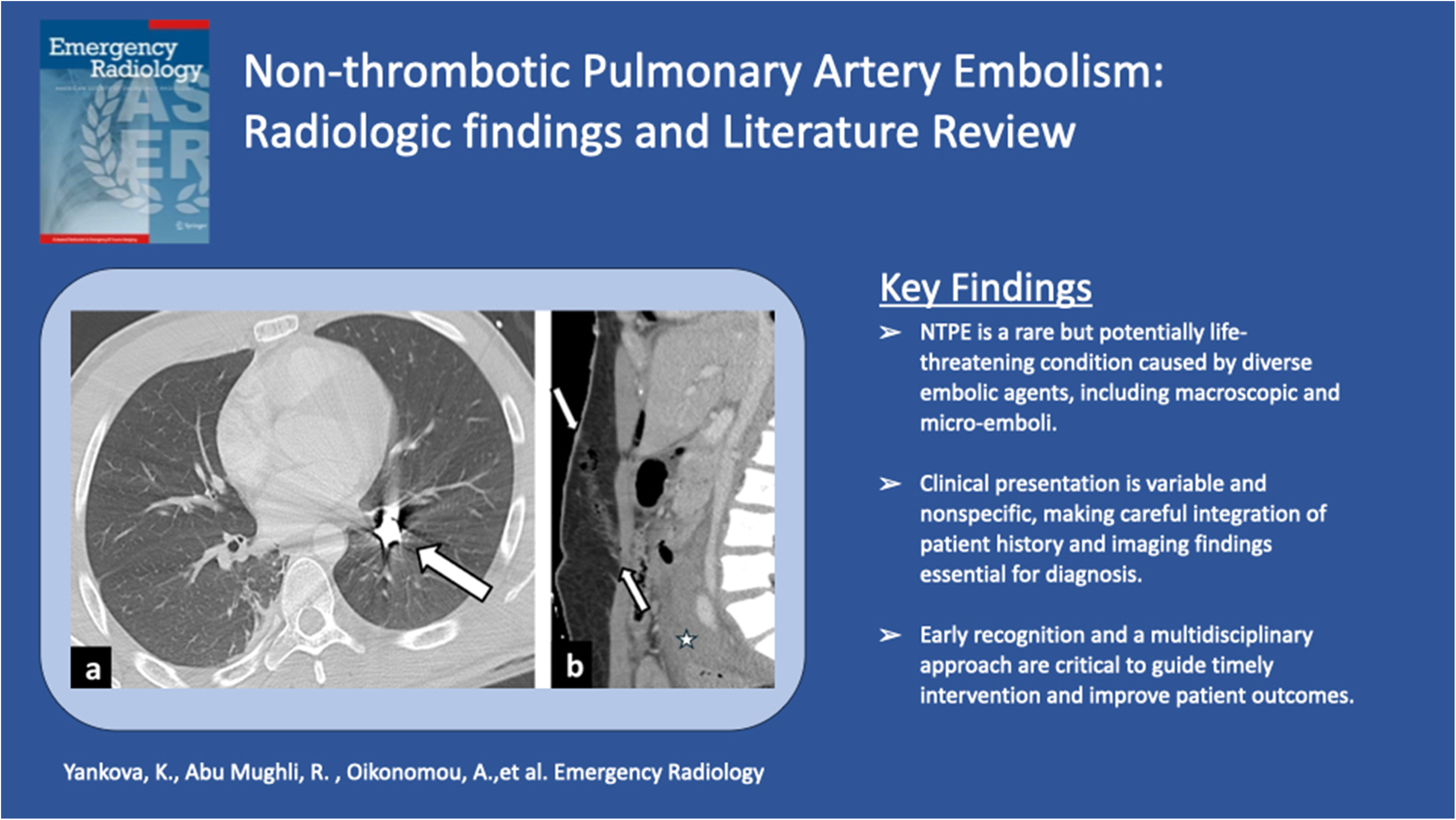 Non-thrombotic pulmonary artery embolism: radiologic findings and literature review