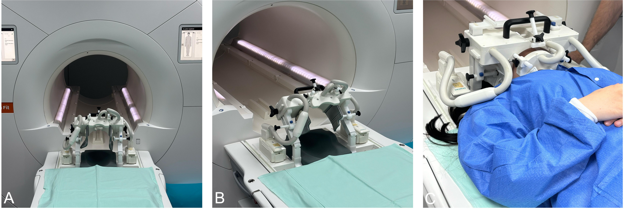 Diagnostic performance of CT and MRI in mandibular trauma assessment – a prospective comparative study