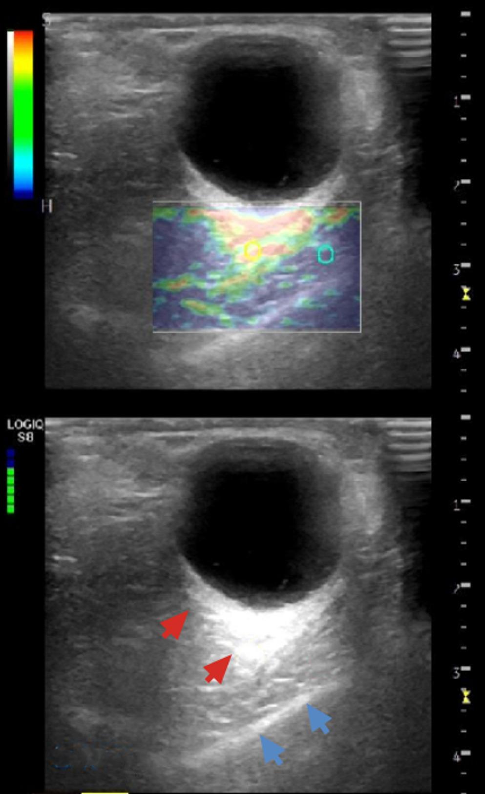 Reliability of extraocular muscle biomechanics in the evaluation of disease activity in thyroid eye disease