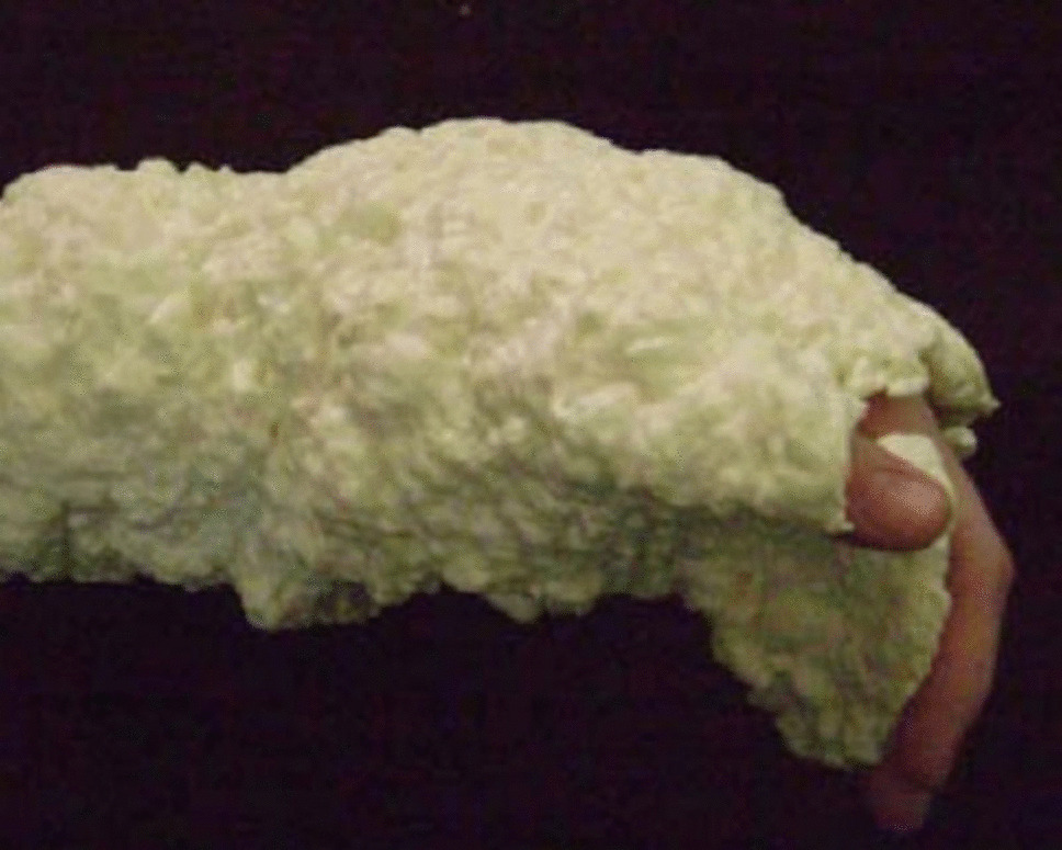 “Recent Technological Advancements in Emergency Department Fracture Stabilization and Management”