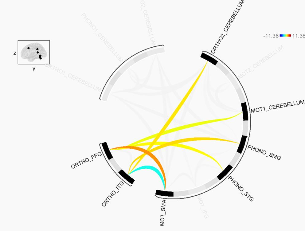 Examining the Cerebral-Cerebellar Connectivity During Spelling Tasks