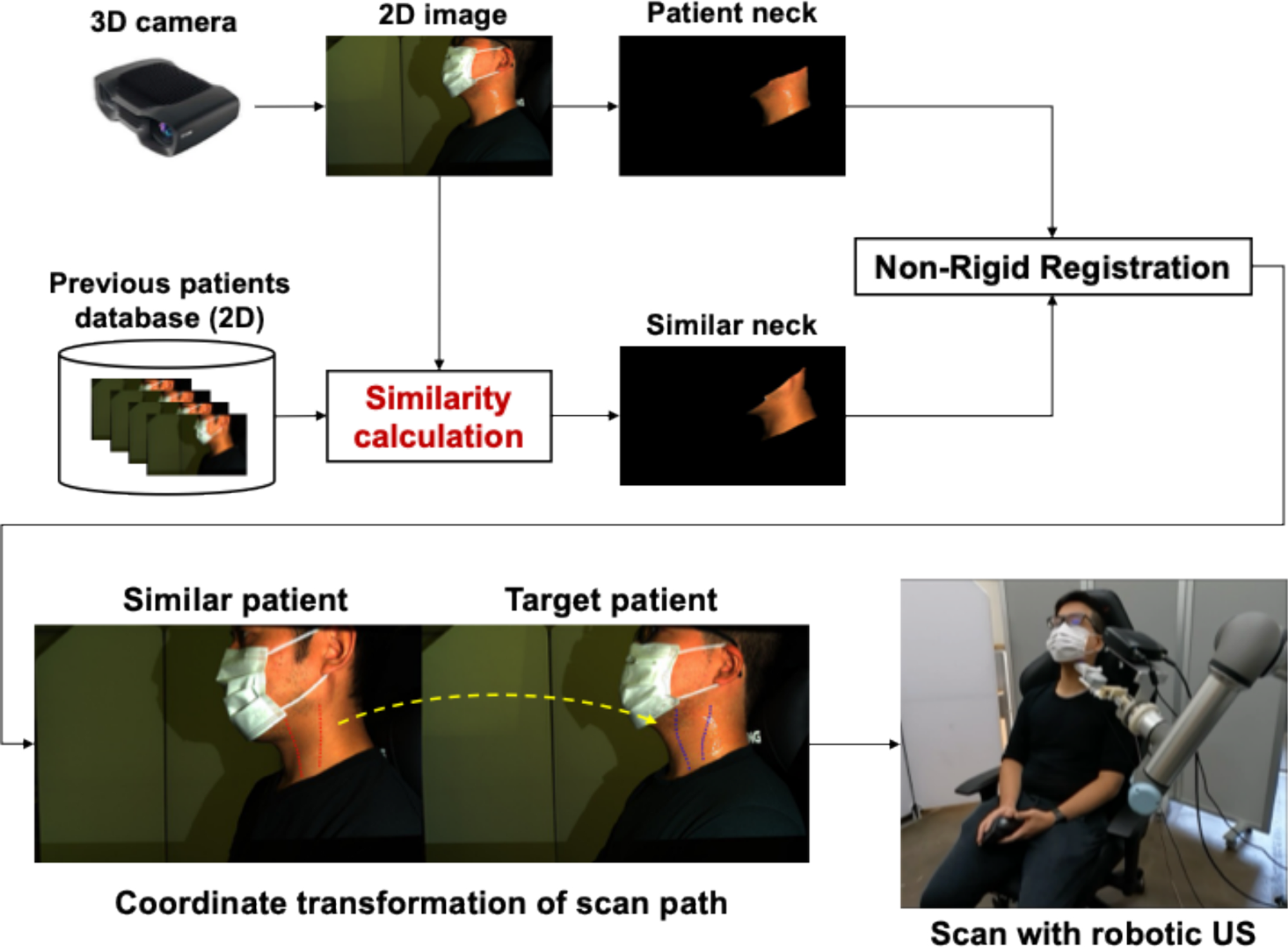 Personalized scan path planning for robotic ultrasound in head and neck lesions