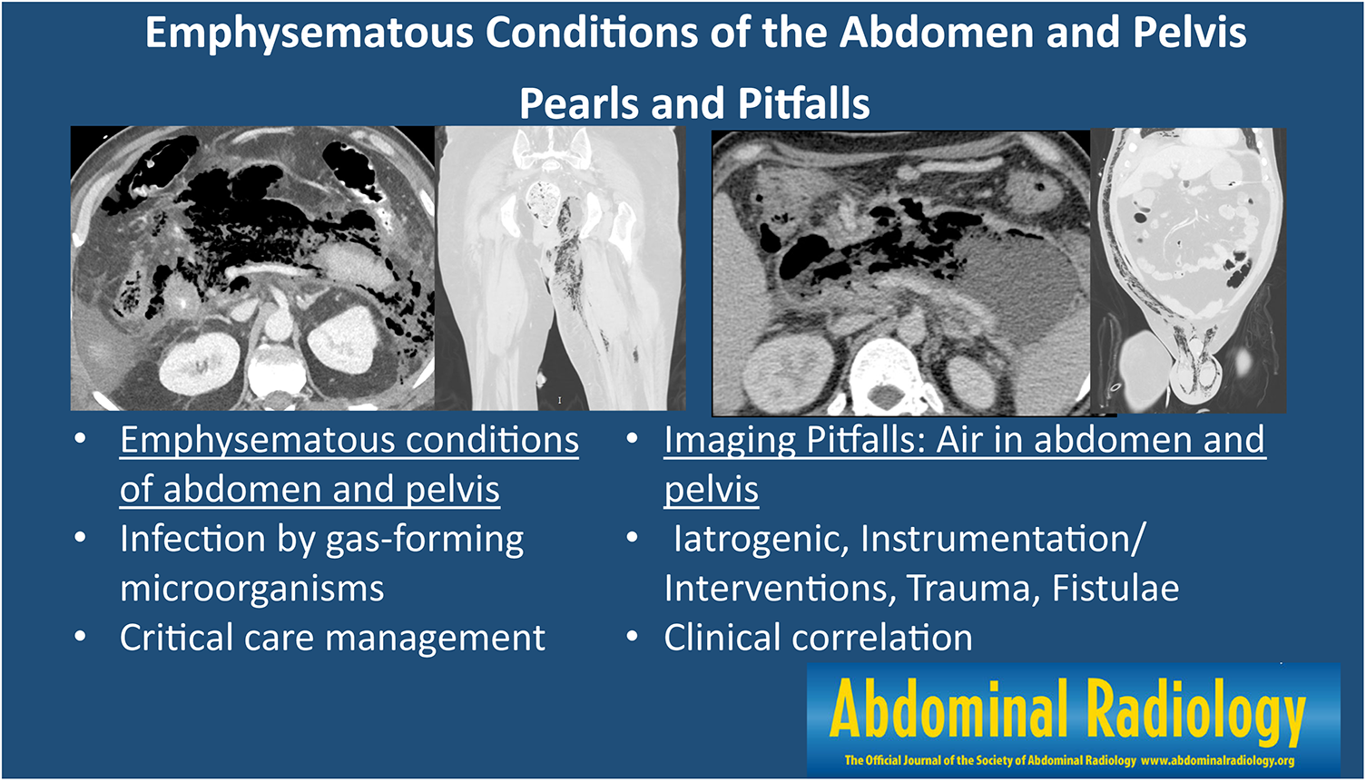 Emphysematous conditions of the abdomen and pelvis: pearls and pitfalls