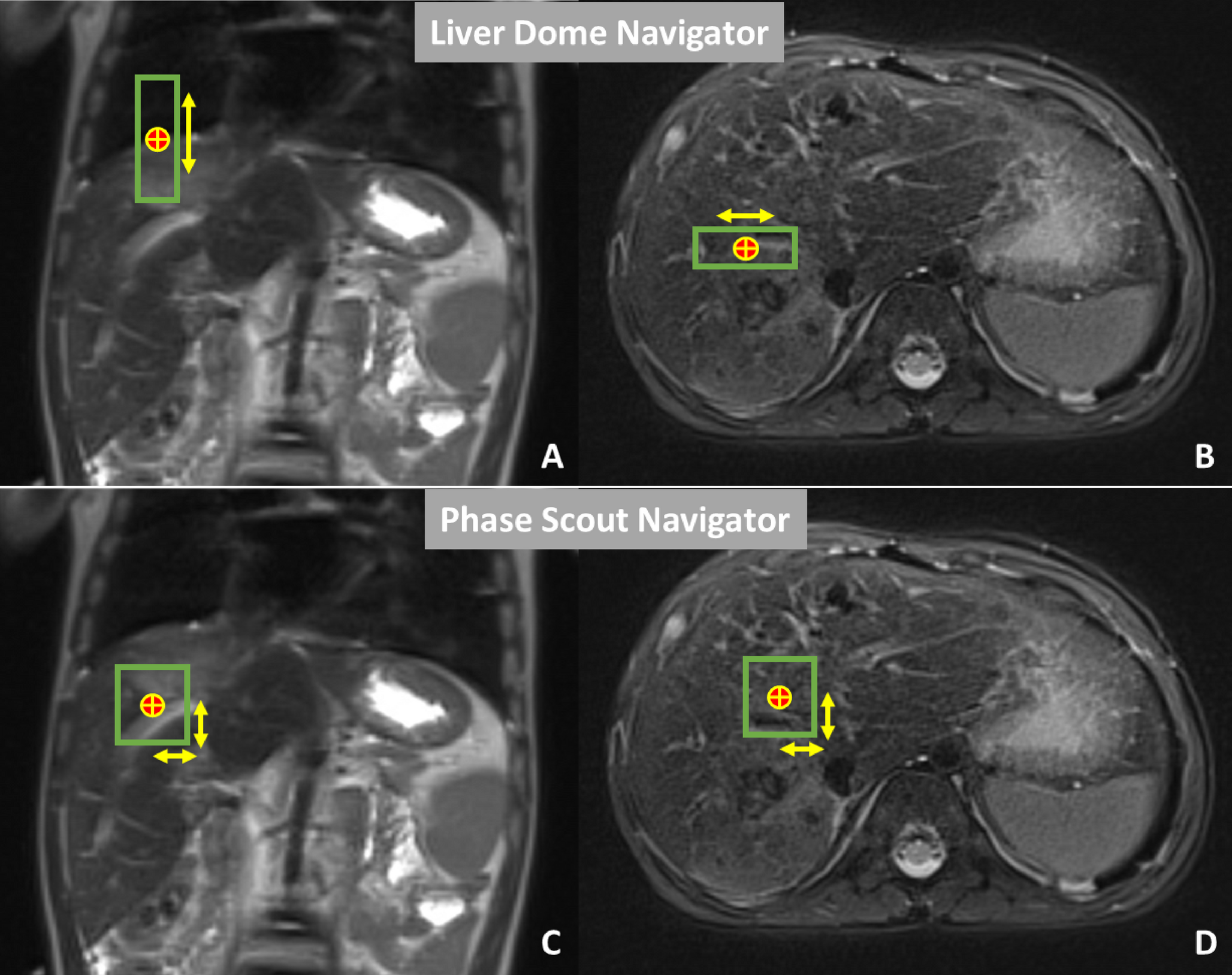 Pediatric 3D MRCP imaging: strategies for enhancing exam quality