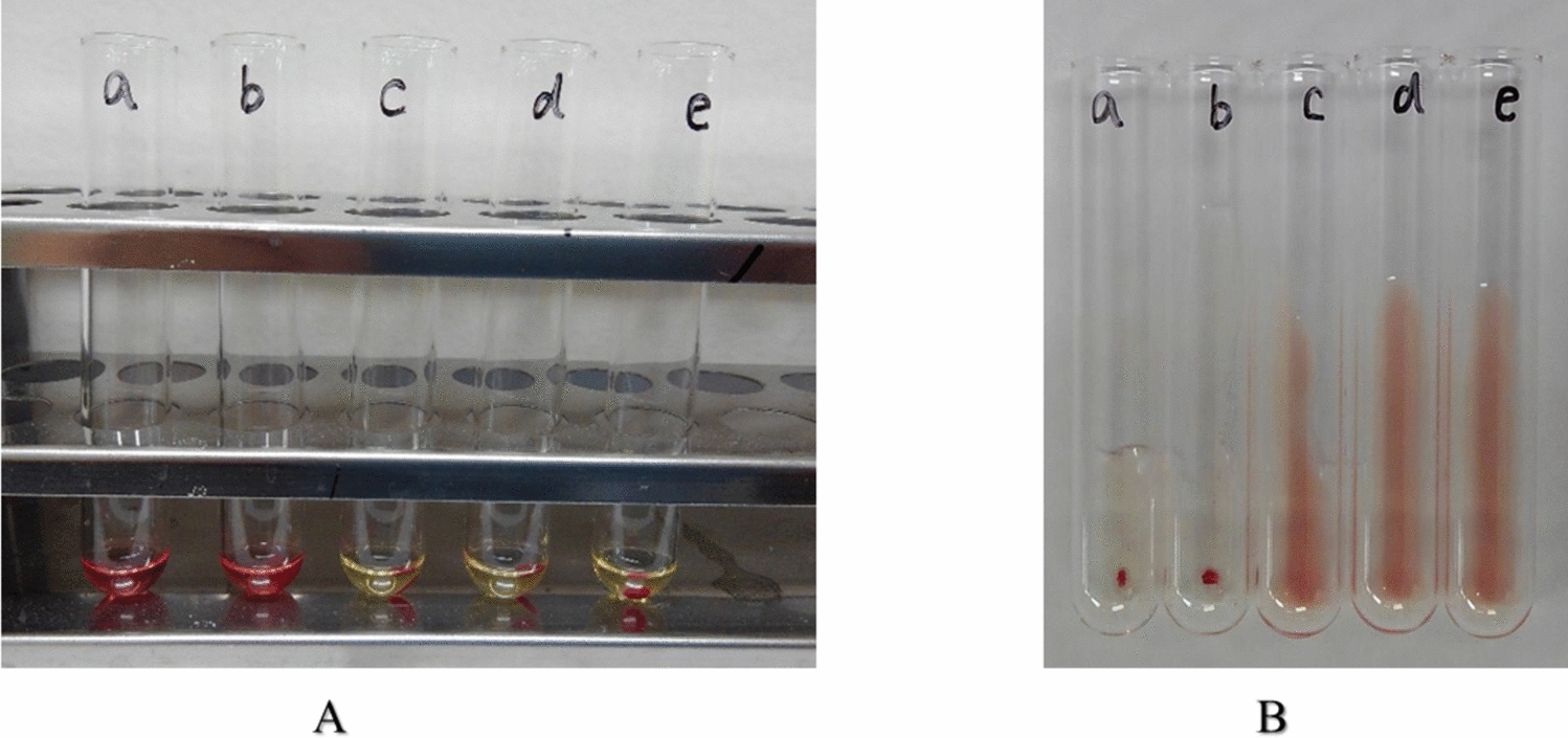 Micafungin-induced hemolytic anemia: a case report and investigation of anti-micafungin antibody prevalence