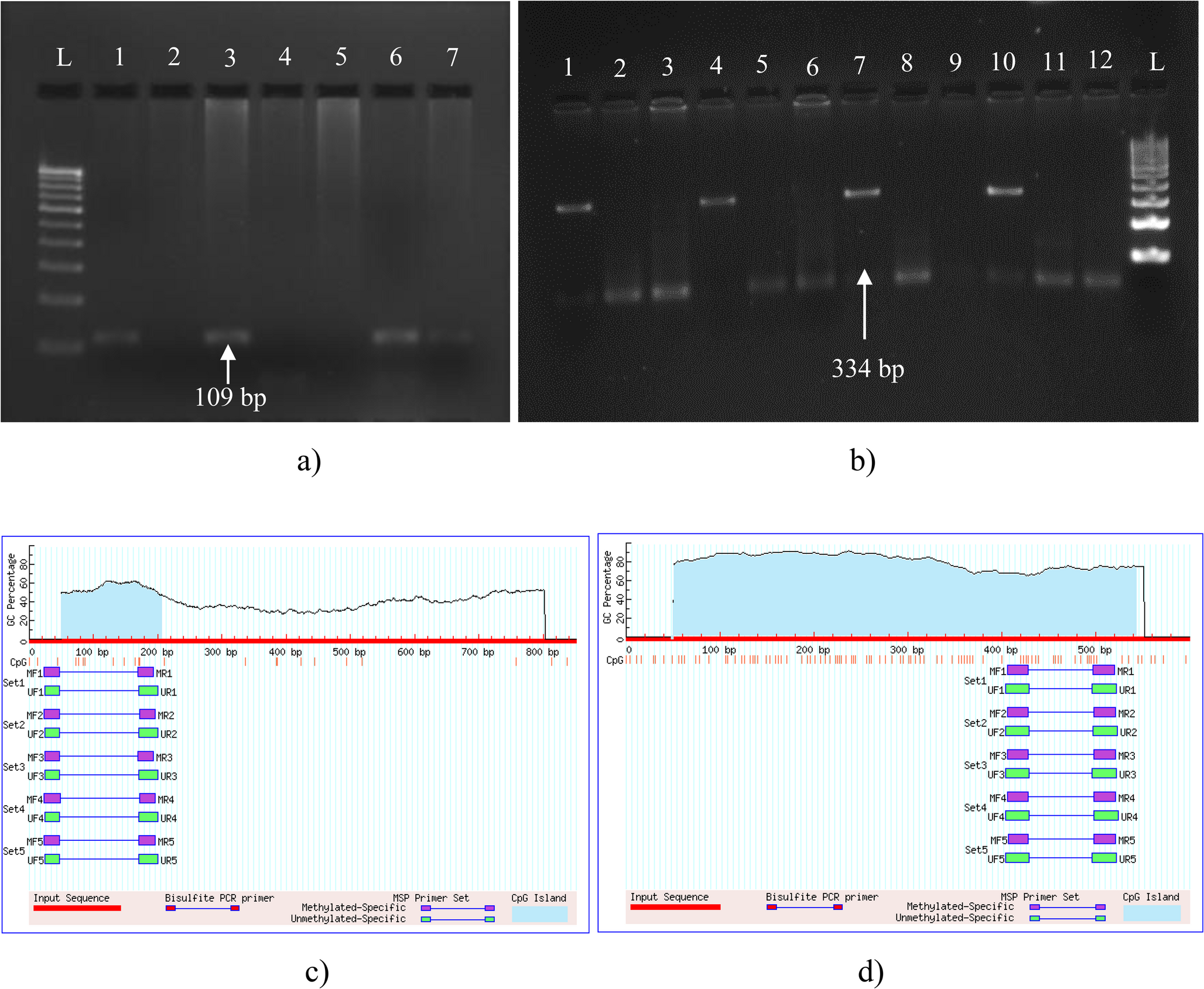 Molecular and bioinformatics analysis of long non-coding RNAs in cervical cancer