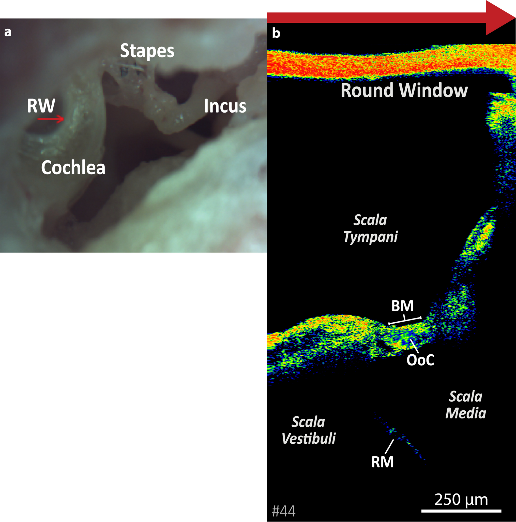 Anatomical Integrity of the Human Cochlea Estimated with Optical Coherence Tomography for Future Clinical Application