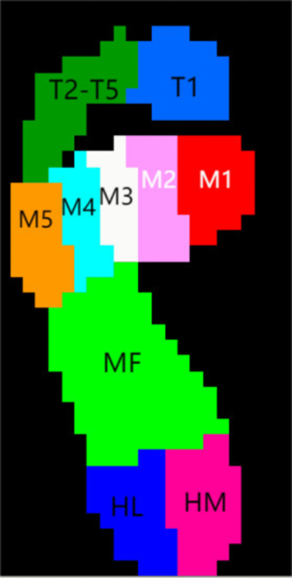 Dynamic plantar pressure changes in Chinese type II diabetes: A 15-month longitudinal study