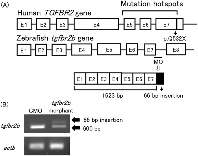 Development of a zebrafish model of Loeys–Dietz syndrome through tgfbr2b knockdown
