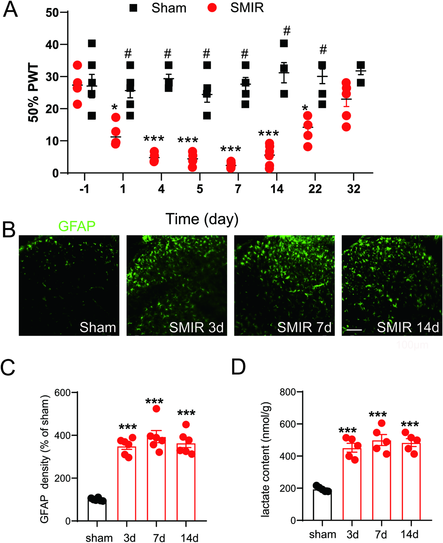 Glucocorticoid-Mediated Astrocytic -Lactate Release Drives Chronic Postsurgical Pain via Spinal Neuronal Sensitization