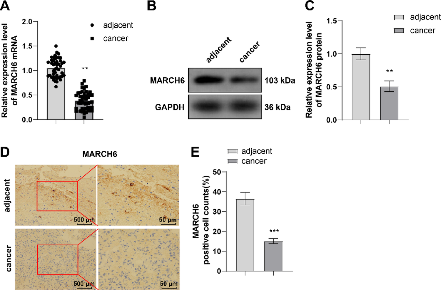 MARCH6 Confers Protection Against Endoplasmic Reticulum Autophagy in Gliomas by Destabilizing FAM134B