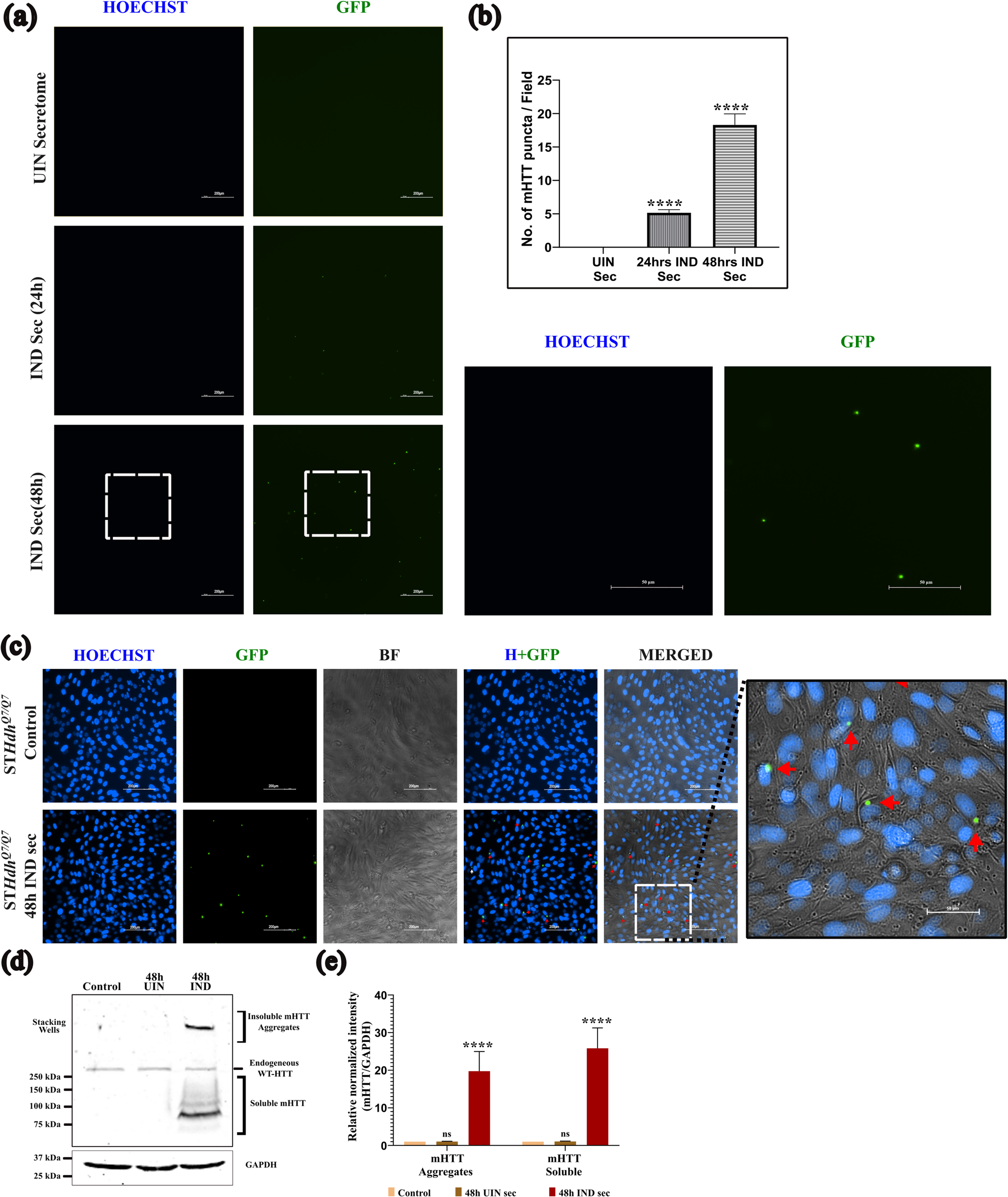 Decanoic Acid Treatment Alleviates Non-cell Autonomous Transfer of HD Pathology by Secretome of Mutant Huntingtin Expressing Cells