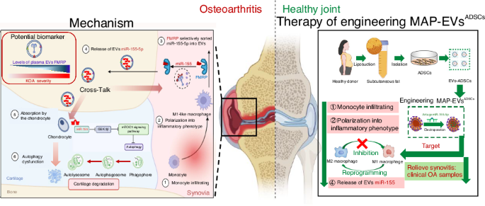 Synovial inflammatory macrophage-derived extracellular vesicles exacerbate cartilage lesions with a FMRP-selectively sorted manner in osteoarthritis