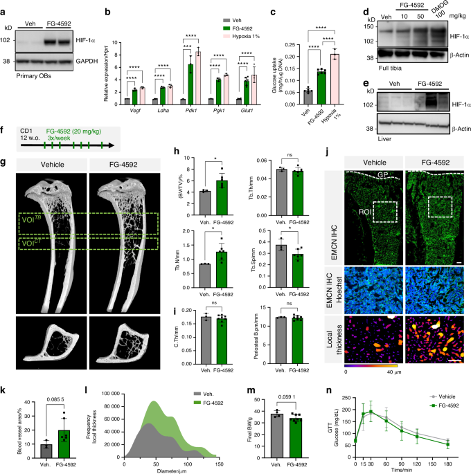 Pharmacological HIF activation protects against diet-induced obesity, glucose intolerance, and skeletal dysfunction by exerting dual beneficial effects on energy metabolism and bone