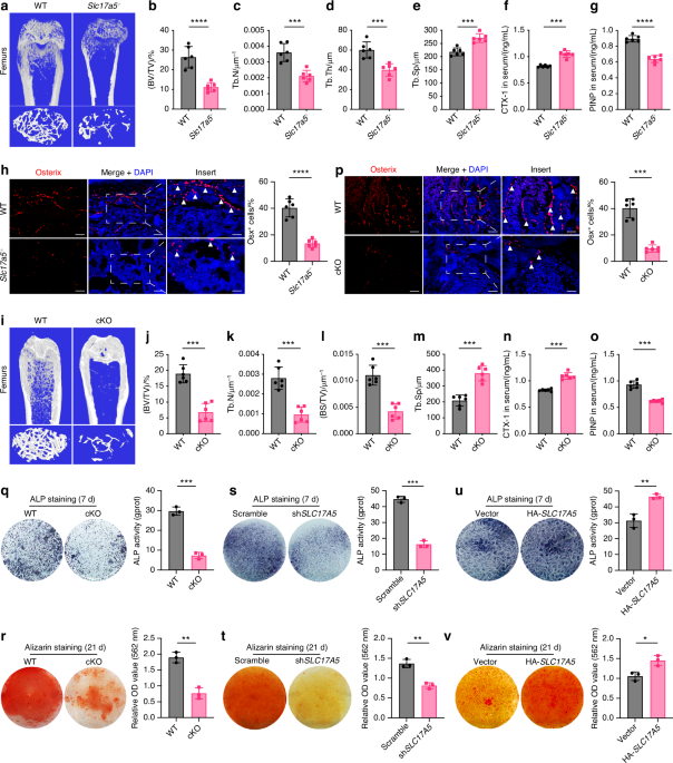 Sialin-STAT3 axis regulates bone homeostasis in mice