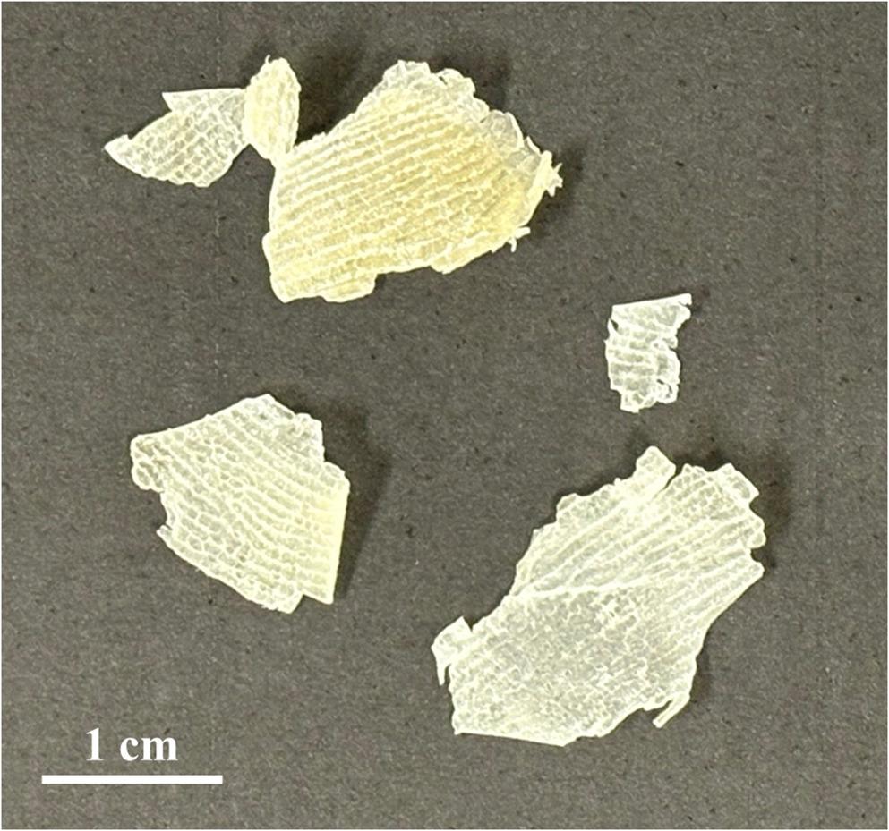 Analysis of intercellular lipids in the stratum corneum of patients with capecitabine-induced hand-foot syndrome: comparison with the stratum corneum of healthy individuals