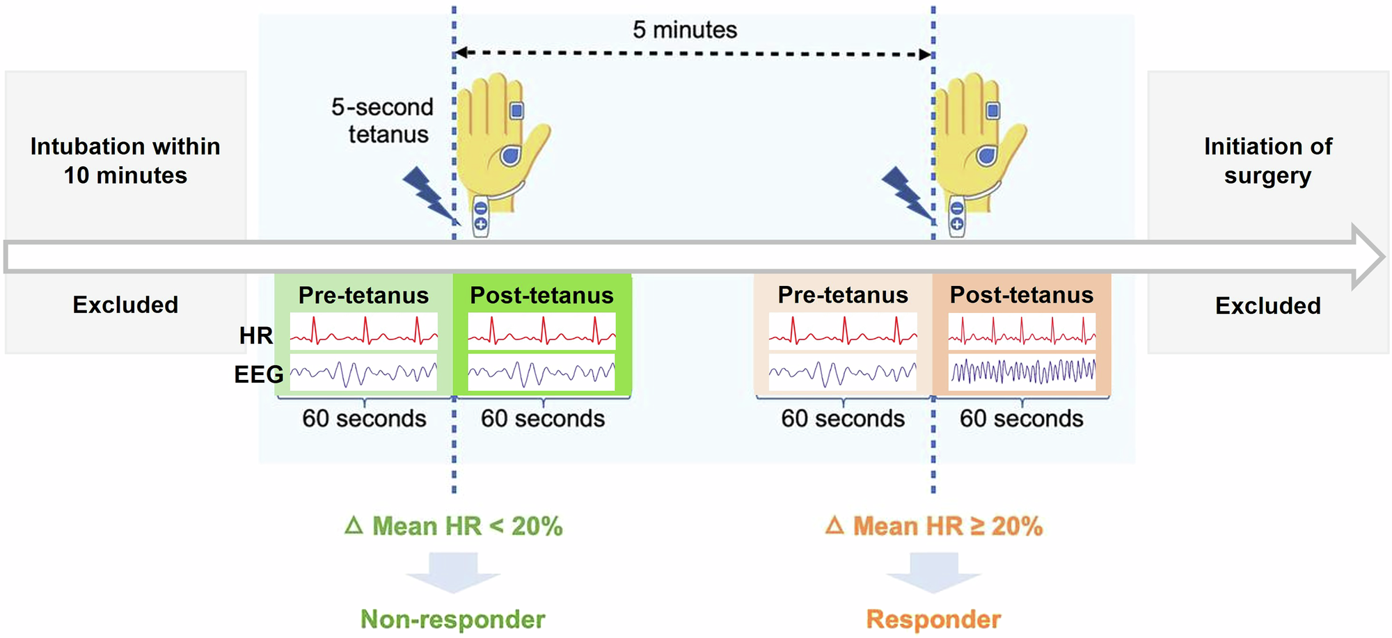 Nociceptive responses to short tetanic stimulation during posttetanic count monitoring in surgical patients: a retrospective cohort study