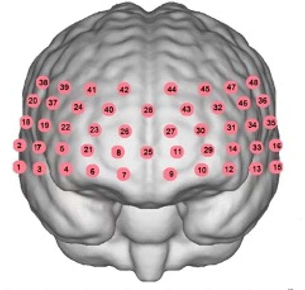 Effects of virtual reality eye movement desensitization and reprocessing therapy for adolescents with major depressive disorder: a functional Near-Infrared spectroscopy study