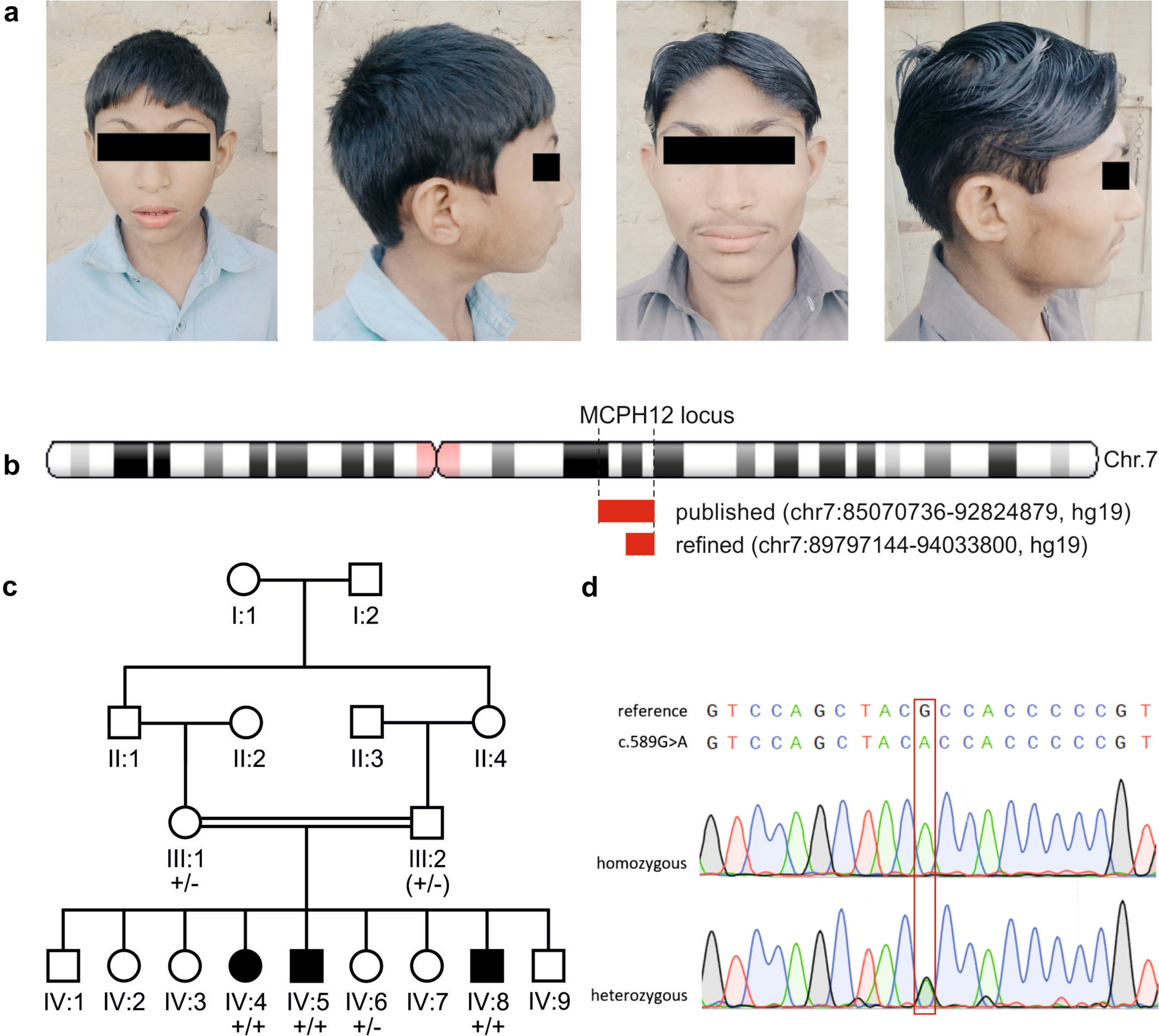 Genetic analysis in a consanguineous MCPH family revealed a refinement of the MCPH12 locus and a founder effect of the recurrent  variant [c.589G>A, p.(Ala197Thr)] in the Pakistani population