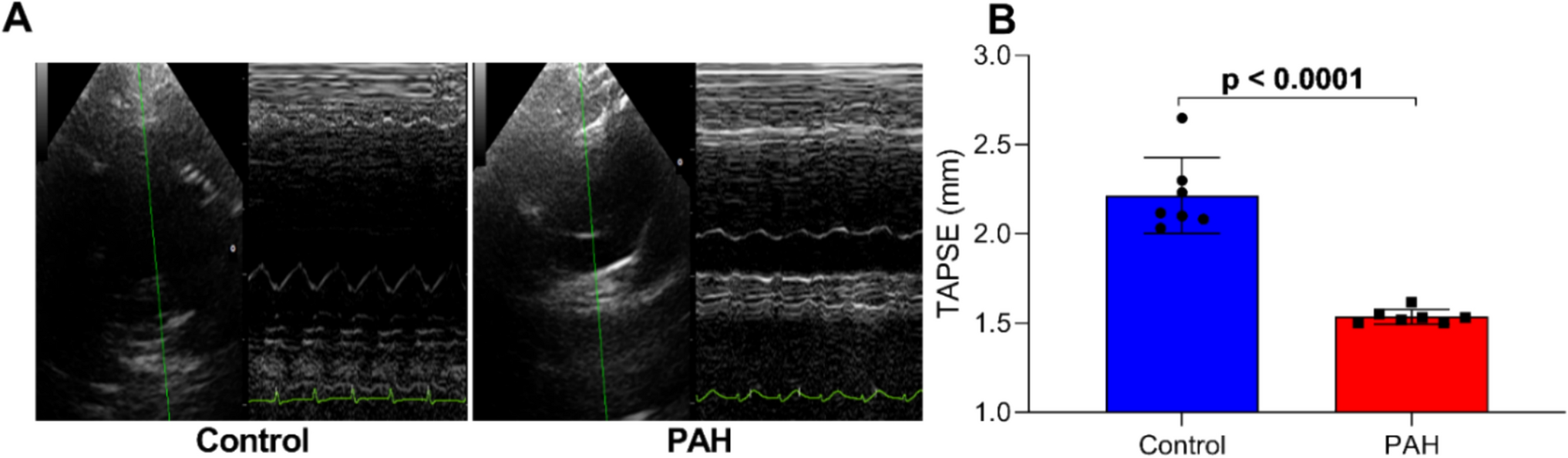 Impact of ionic imbalances on rat cardiomyocyte function in pulmonary arterial hypertension: insights from energy dispersive X-ray spectroscopy and scanning electron microscopy analysis