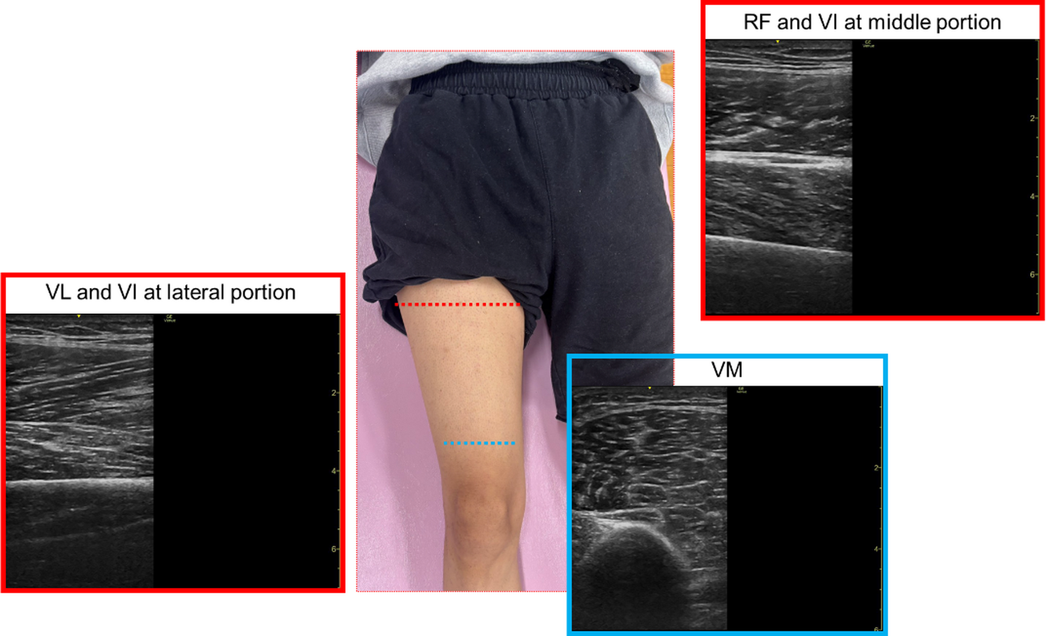 Strength gains and absence of hypertrophy and cross-education in knee extensors following short-term low-volume eccentric training in untrained young men