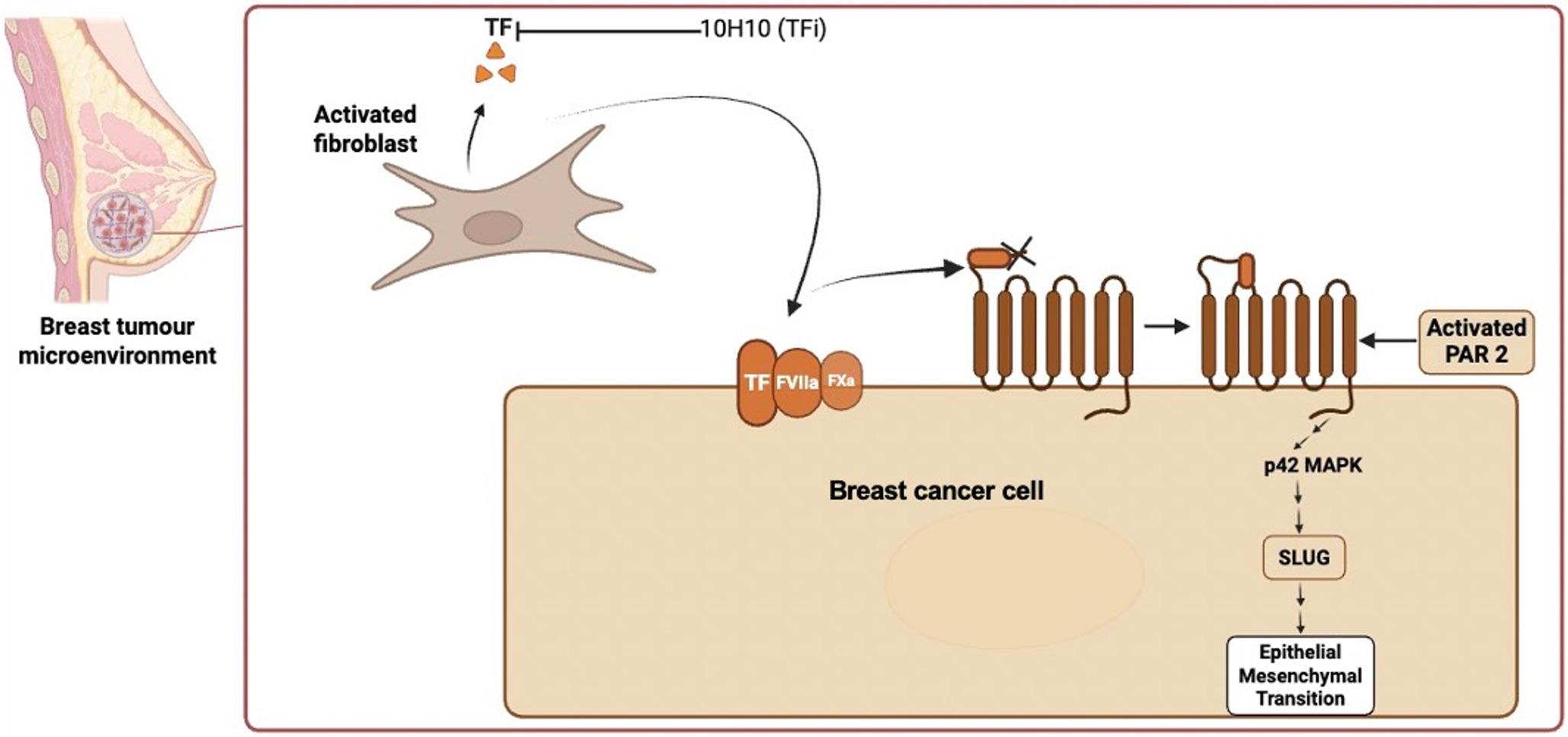 Patient-Derived Procoagulant Breast Fibroblasts Expressing Tissue Factor Promote Breast Cancer Cell Migration