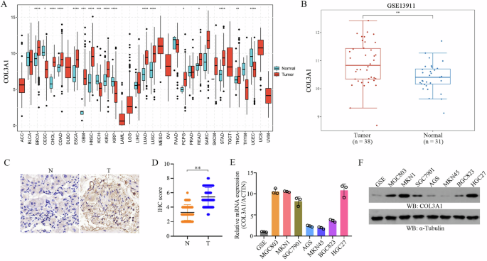 COL3A1 promotes gastric cancer progression by activating PI3K/AKT signaling
