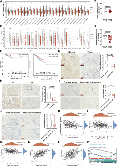 The FOSB-IGFBP5-IGF-1 axis: a novel regulatory pathway that suppresses prostate cancer growth