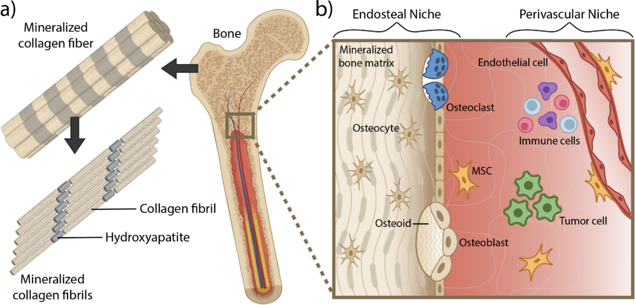 Engineered bone matrix models for understanding breast cancer skeletal metastasis
