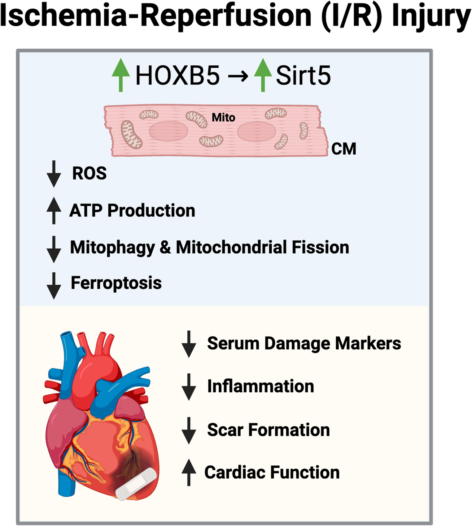 Mitochondria at the Heart of Ischemia-Reperfusion (I/R) Injury: the HOXB5-Sirt5 Axis