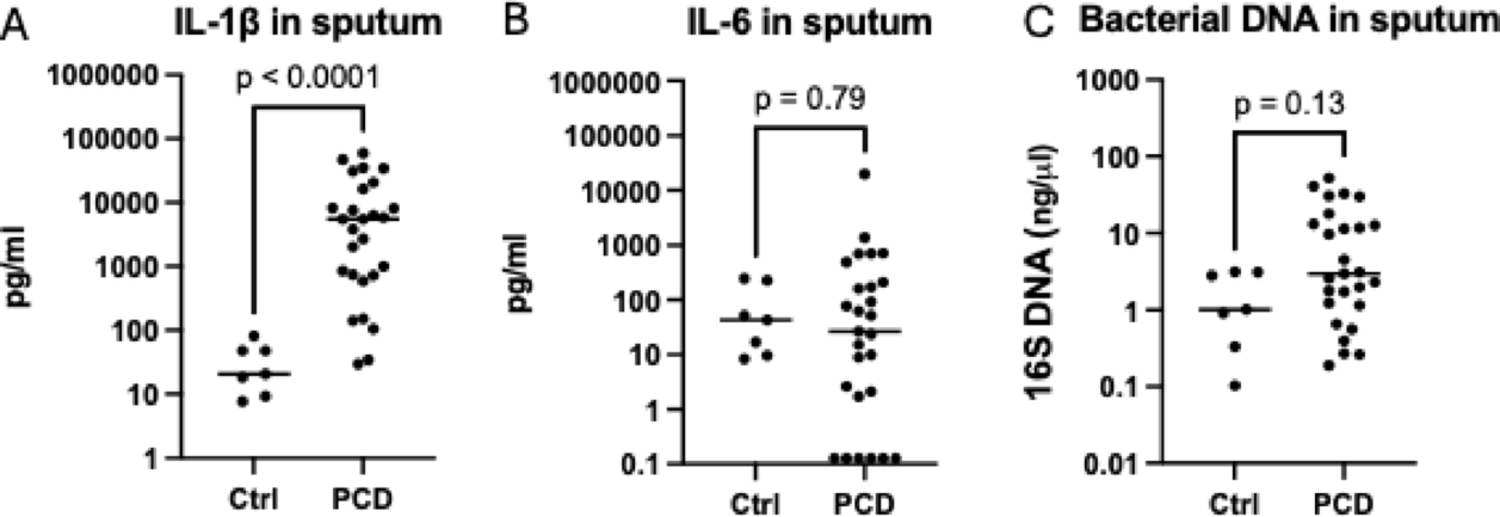 Sputum from Individuals with Primary Ciliary Dyskinesia Drives M2-like Macrophage Polarization
