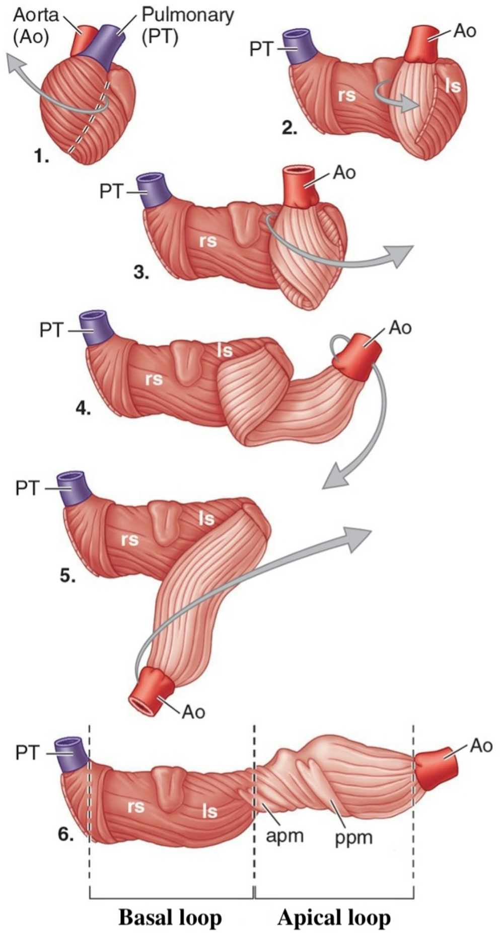 Acute Right Ventricular Failure in the Medical ICU