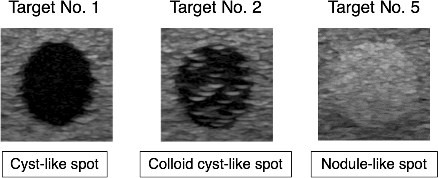 Explorative research on image quantification methods for setup conditions and quality control of ultrasound devices in thyroid ultrasonography