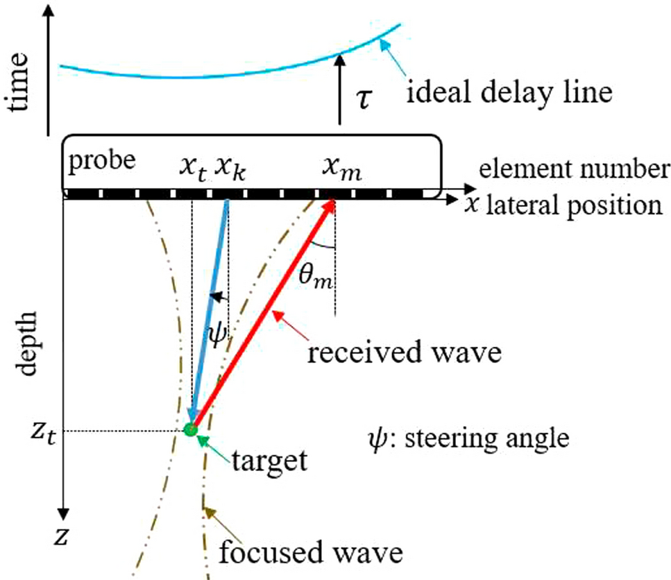 Phantom experiment for thoracic spine gap delineation using steering-transmitted ultrasound to assist epidural anesthesia