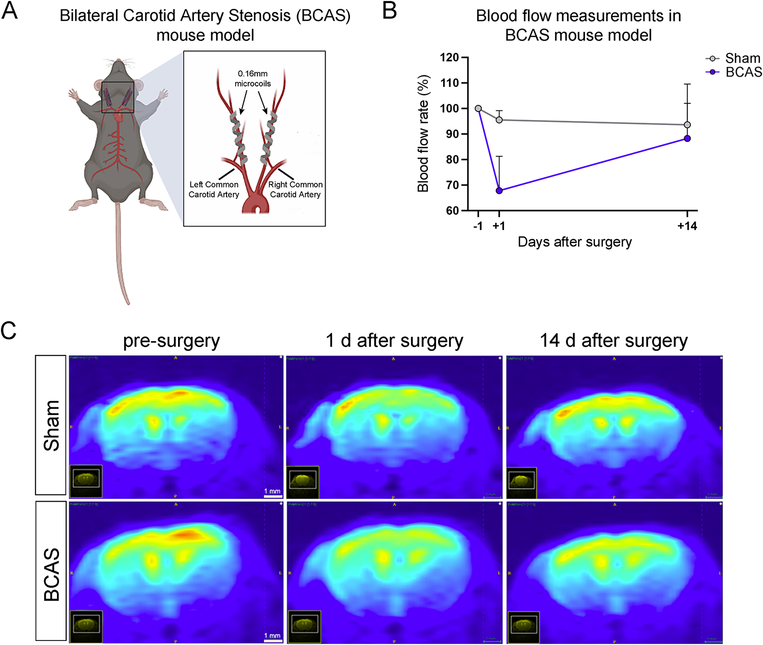 Cerebral Hypoperfusion Causes Behavioral Changes and Impairs the Rod Photoreceptor Pathway in the Retina of Aged Mice
