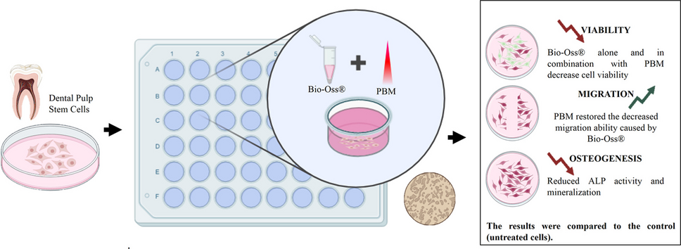 Effects of photobiomodulation on human dental pulp stem cells treated with a bone xenograft: An in vitro study