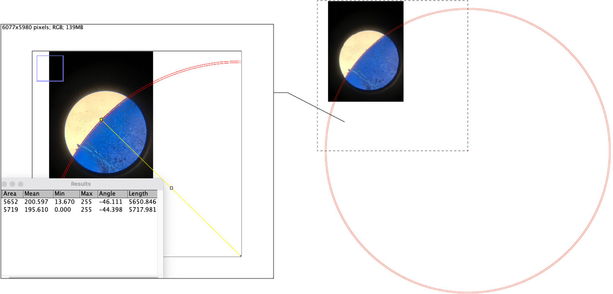 Efficacy and safety analysis of LenSX and Catalys femtosecond laser systems in short axial length patients