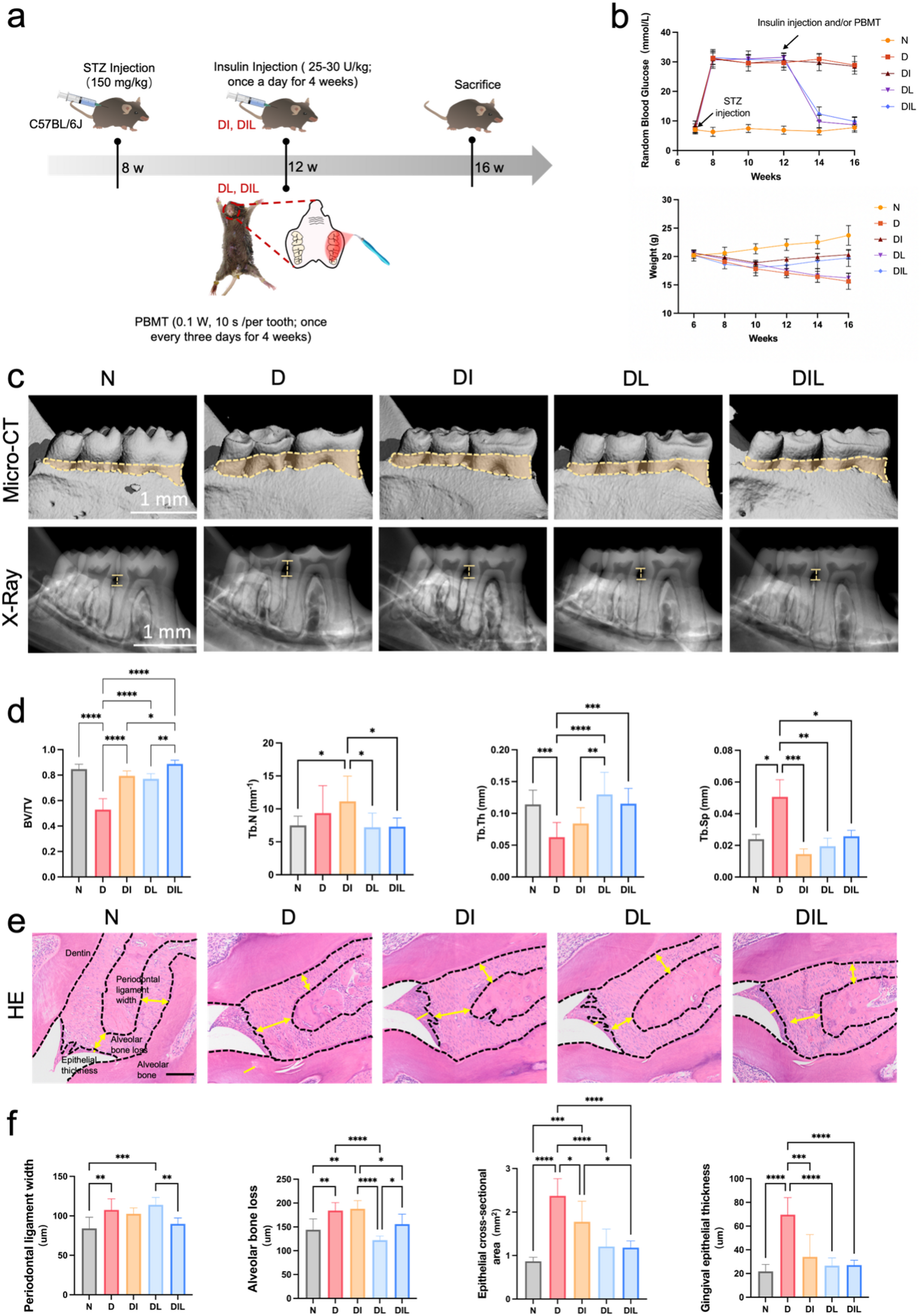 Photobiomodulation therapy reduces diabetic periodontal damage through modulation of macrophage metabolism and functions