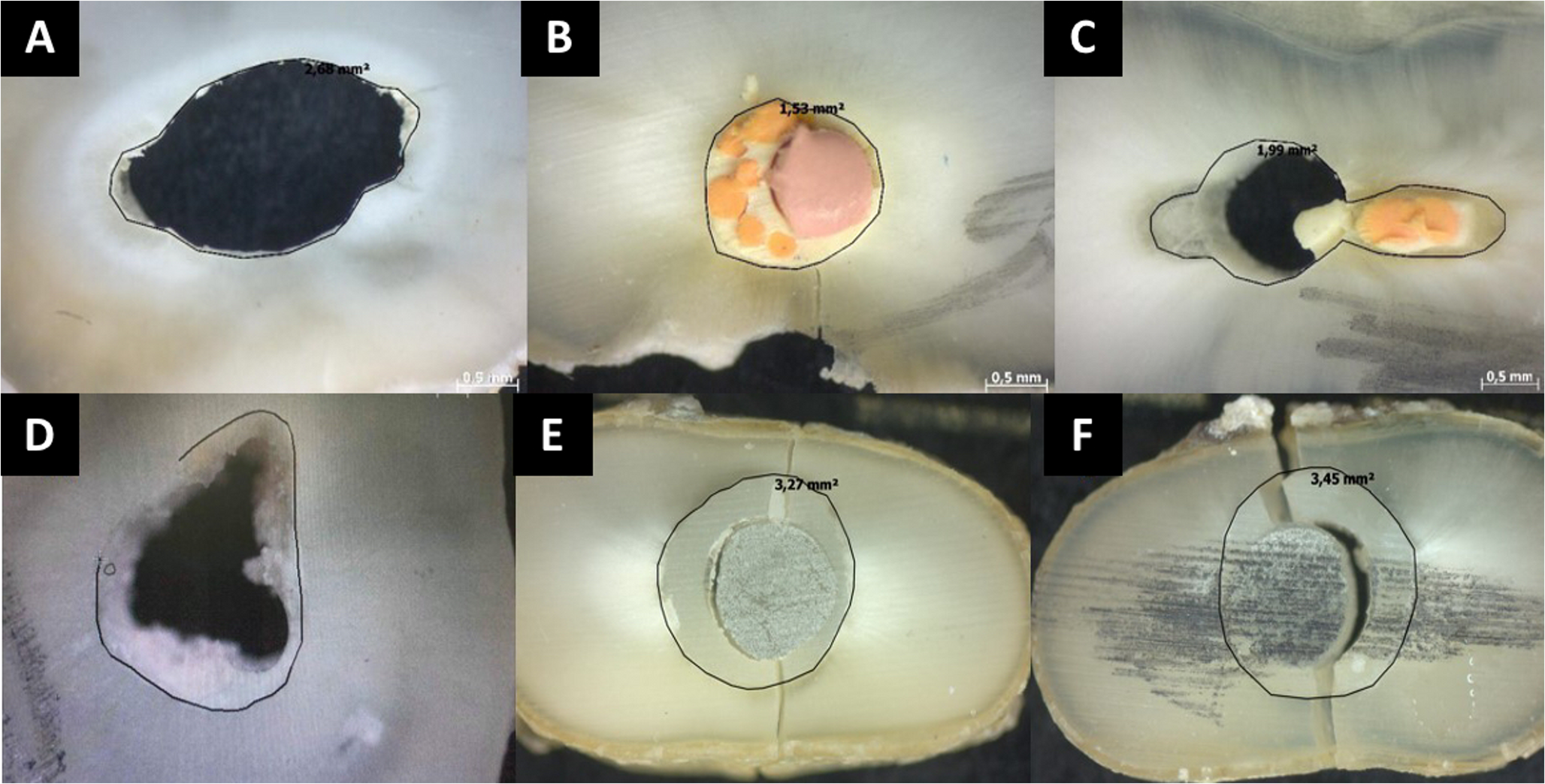 Influence of different final irrigation protocols for removal of photosensitizer activated by ultrasonic device on the bond strength of gutta-percha/bioceramic sealer and fiberglass posts/self-adhesive cement