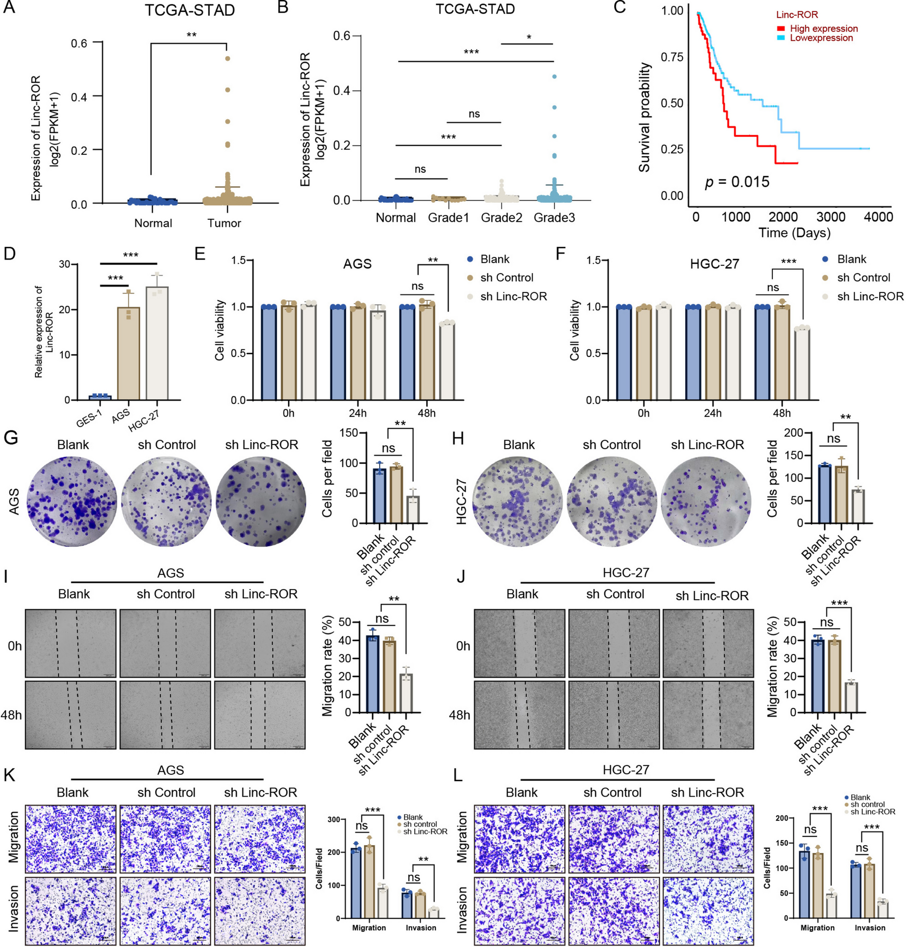 Linc-ROR orchestrates autophagy suppression and marks gastric cancer via the miR-145-5p/CARMIL1 axis
