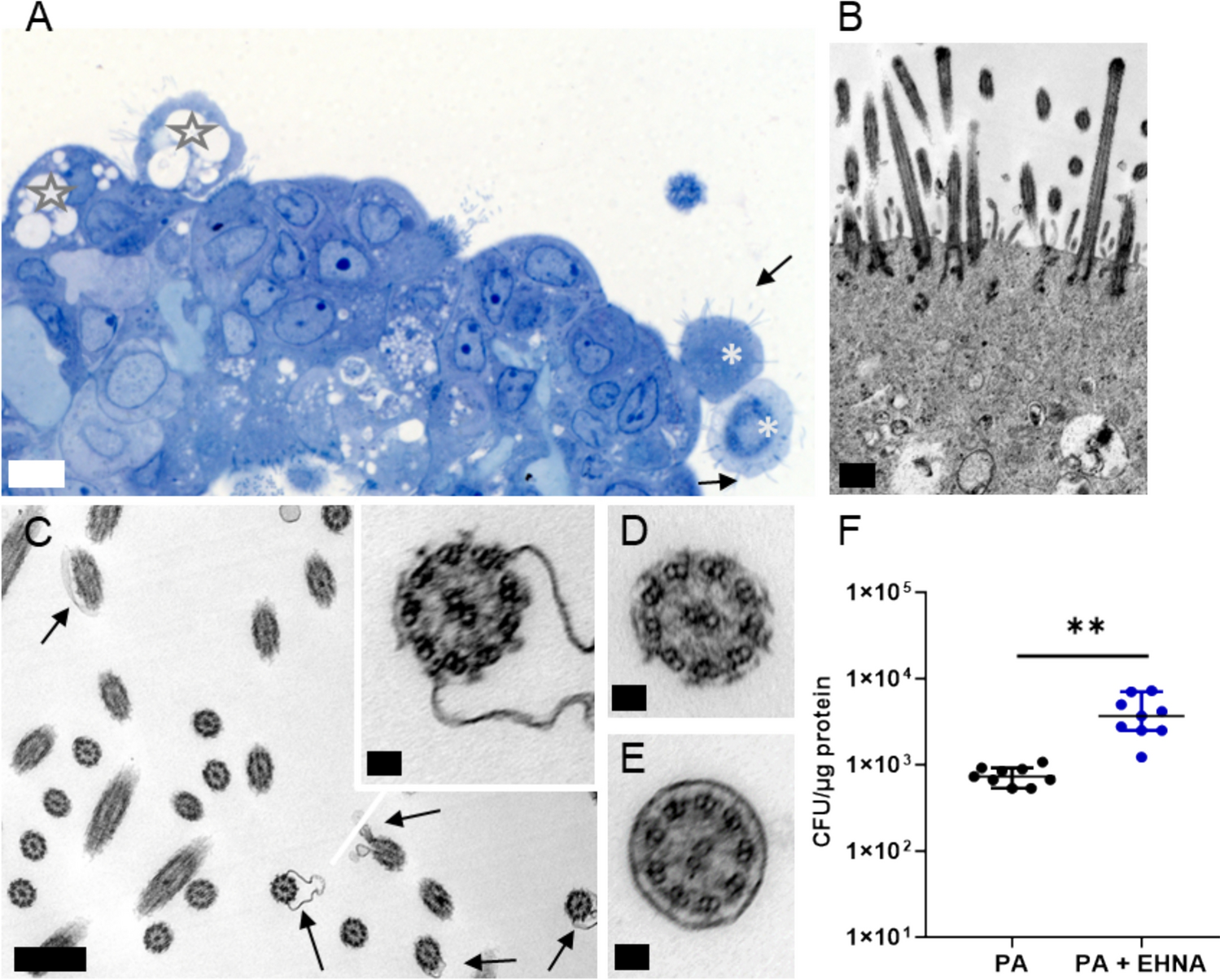 The role of ciliary function in airway epithelial defense against