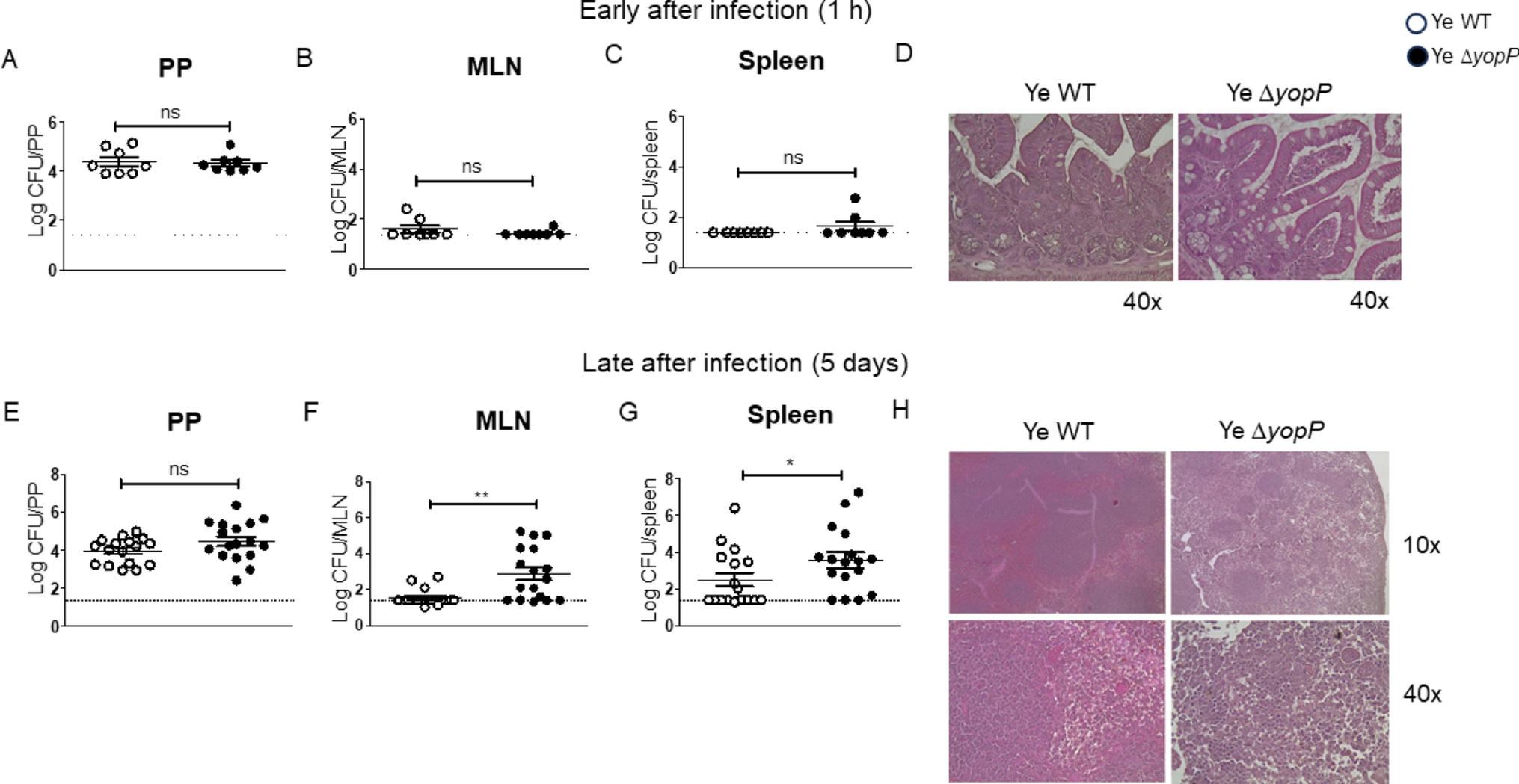 YopP modulates bacterial virulence and systemic dissemination in Peyer´s patches during murine  infection